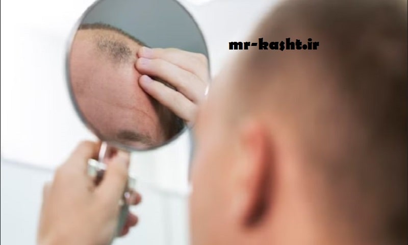 کچلی بعد از کاشت