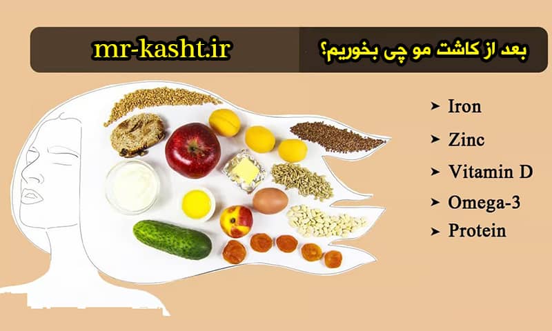 بعد از کاشت مو چی بخوریم؟